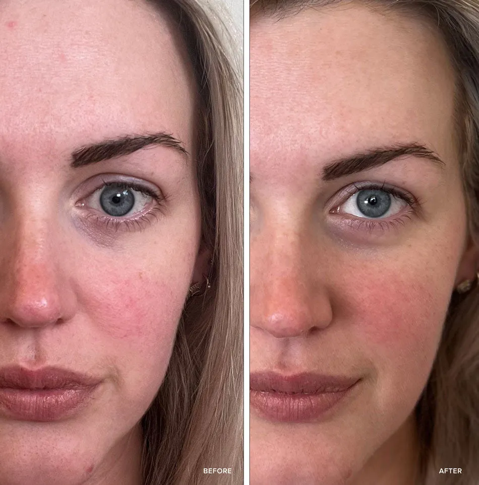 Instant Glow Face Masque (FREE)